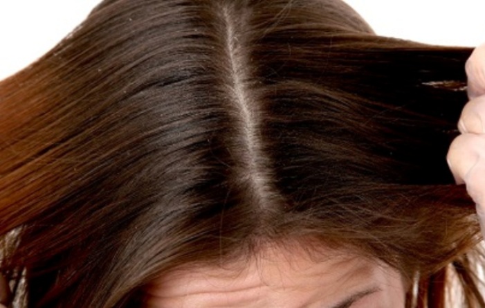 rimedi naturali per capelli grassi