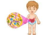 Quali alimenti aggravano la diarrea nei bambini