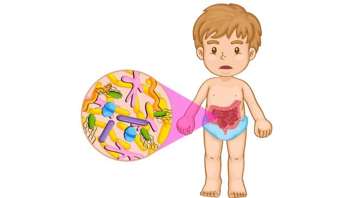 Quali alimenti aggravano la diarrea nei bambini