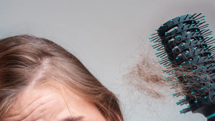 Caduta di capelli nelle donne: cause e rimedi